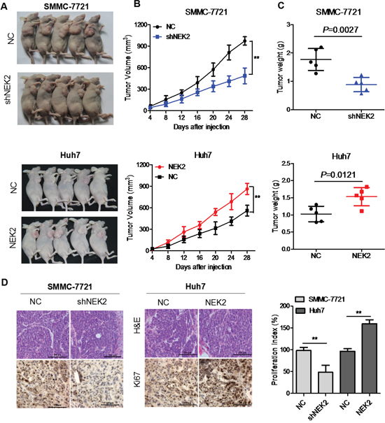 NEK2 promotes HCC tumor growth in vivo.