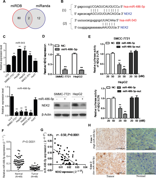 NEK2 is a target for miR-486-5p in HCC cells.