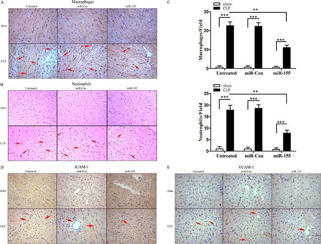 Transfection of miR-155 mimic prevents infiltration of macrophages and neutrophils into the myocardium and reduces adhesion molecule expression in late sepsis.