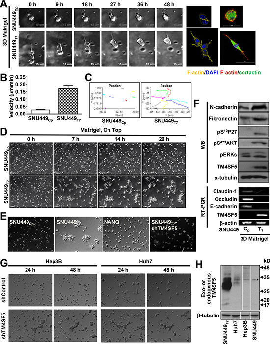TM4SF5-expressing cells showed invasive behaviors in 3D Matrigel.