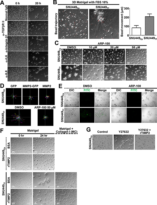 Extracellular matrix remodeling was important for the TM4SF5-mediated invasive foci formation in 3D Matrigel.