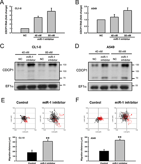 Treatment with miR-1 inhibitor increased CDCP1 expression and tumor cell mobility.