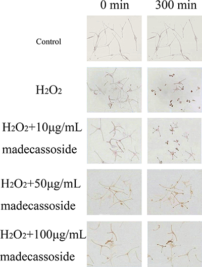 Effect of madecassoside on H2O2-treated human melanocytes.