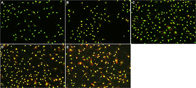 Madecassoside induced autophagy activation in H2O2-treated melanocytes.