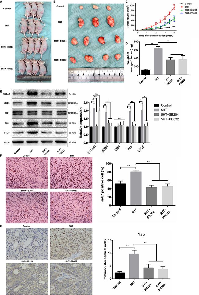 The 5-HT-Yap axis promoted the malignant biological behavior of hepatoma cells by activating Yap in vivo.