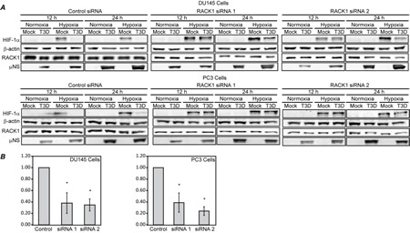 RACK1 knockdown by siRNAs prevents MRV-induced HIF-1&#x3b1; degradation in hypoxic tumor cells.