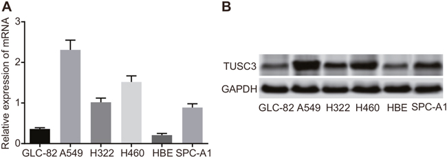 TUSC3 mRNA and protein expression in human NSCLC cell lines (A549, GLC-82, H322, H460, SPC-A1, and HBE).