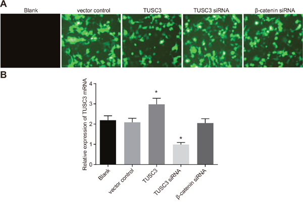 Transfection efficiency of human NSCLC A549 cells in the blank, vector control, TUSC3, TUSC3 siRNA, and &#x03B2;-catenin siRNA groups.