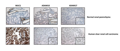 MUC1, ADAM10 and ADAM17 expression in human tissue.