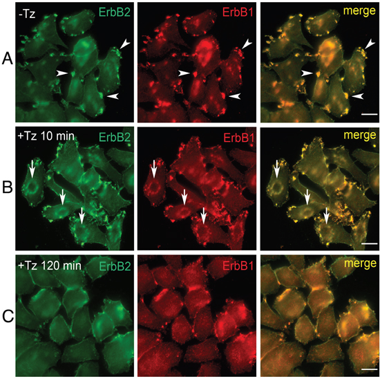 Trastuzumab (Tz) treatment modifies ERBB2 plasma membrane (PM) distribution and induces the formation of Circular Dorsal Ruffles (CDRs).