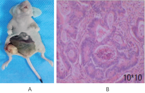 Transplanted tumor in nude mice inoculated with CD133+ HT29 colon carcinoma cells.