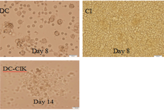 Morphology of DC-CIK cells under the light microscope (magnification 400&#x00D7;).