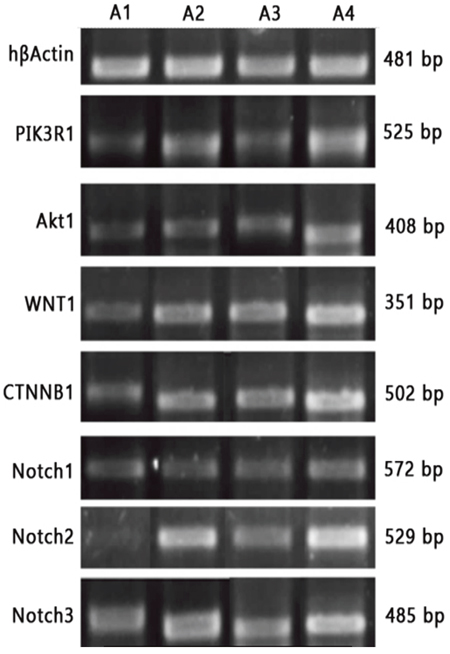 RT-PCR detections of mRNA expressions of key genes.