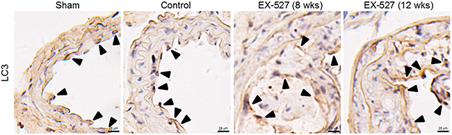 EX-527 treatment did not further change LC3 expression in the collared carotid artery of ApoE-/- mice.