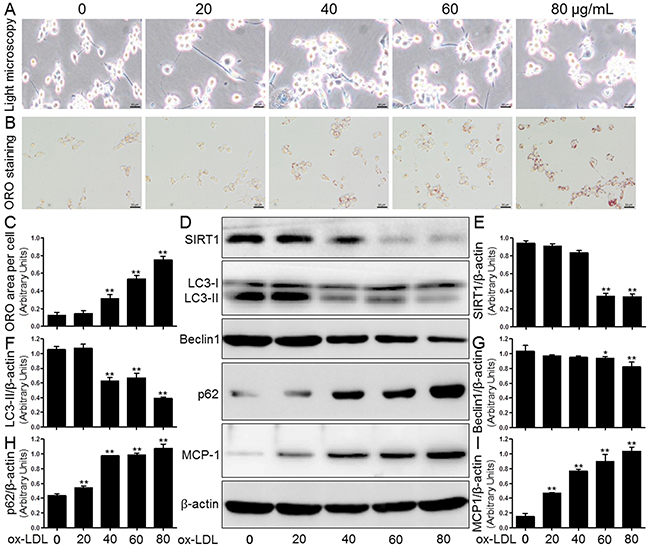 Ox-LDL induced macrophage foam cell formation, SIRT1 inhibition, autophagy impairment, and MCP-1 production in THP-1 cells.