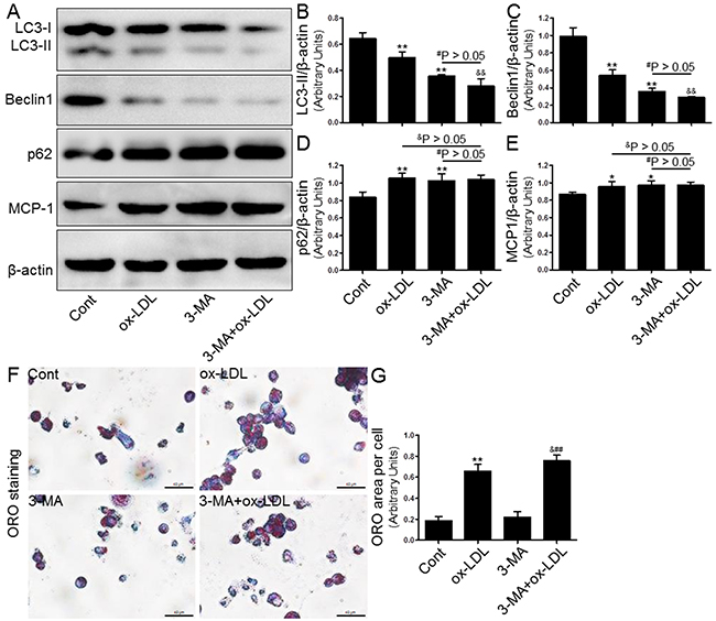 Inhibition of autophagy with 3-MA led to increased foam cell formation and MCP-1 production.