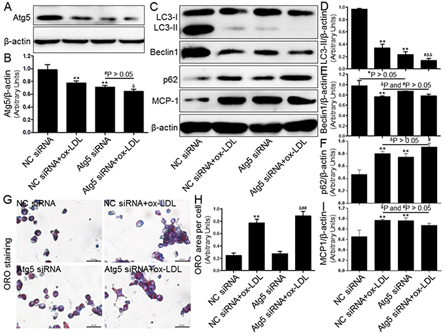 Inhibition of autophagy using Atg5 siRNA aggravated foam cell formation and MCP-1 expression.