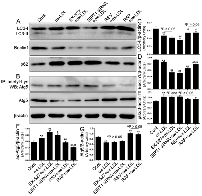 Inhibiting SIRT1 using EX-527 and SIRT1 siRNA further blocked autophagy that was down-regulated by ox-LDL exposure.
