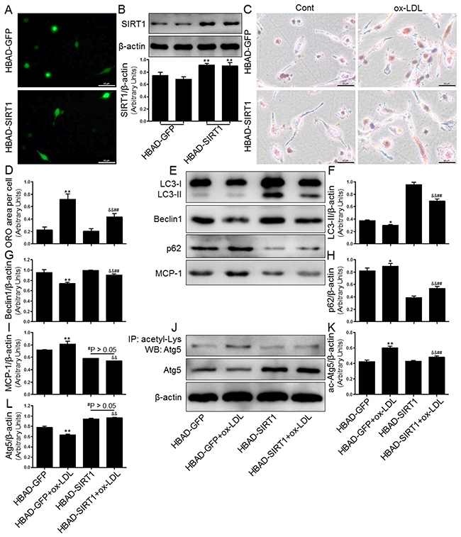 Overexpression of SIRT1 using adenoviral transfection reversed ox-LDL-induced macrophage foam cell formation and autophagy impairment in THP-1 cells.