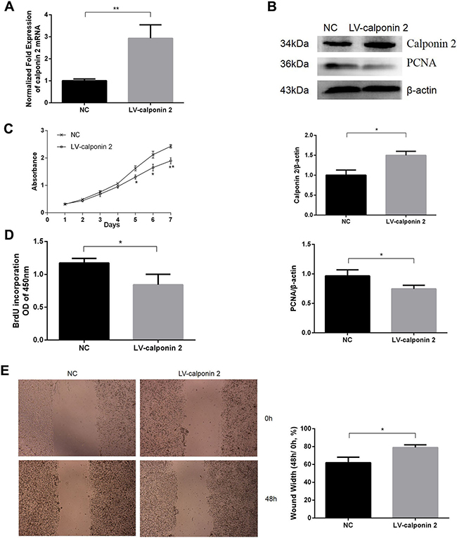 Overexpression of calponin 2 inhibits proliferation and migration of pancreatic cancer cells.
