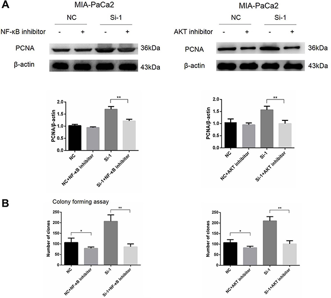 NF-&#x03BA;B and AKT signals promote cell proliferation in calponin 2-knockdwon pancreatic cancer cells.