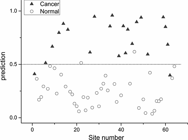 Scatter plot of the posterior probability model using partial linear square technique of patients with normal nasopharynx versus nasopharyngeal cancer (sensitivity 91%; specificity 95%).