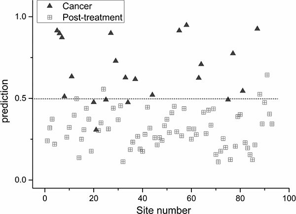 Scatter plot of the posterior probability model using partial linear square technique of patients with post-irradiated nasopharynx versus nasopharyngeal cancer (sensitivity 77%; specificity 96%).