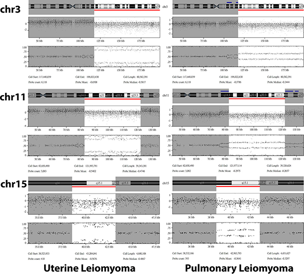 Details of the shared copy number variations identified in the uterine (left panel) and pulmonary (right panel) leiomyoma from case 2.