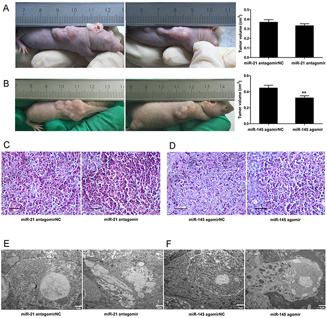 Down-regulated microRNA-21 and up-regulated microRNA-145 expressions produced opposing effects on tumor burden and promoting effects on apoptosis in vivo.