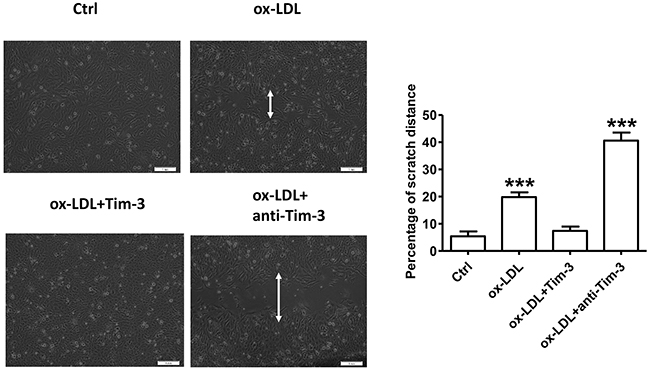 Tim-3 reverses ox-LDL-induced inhibition of HUVECs migration.