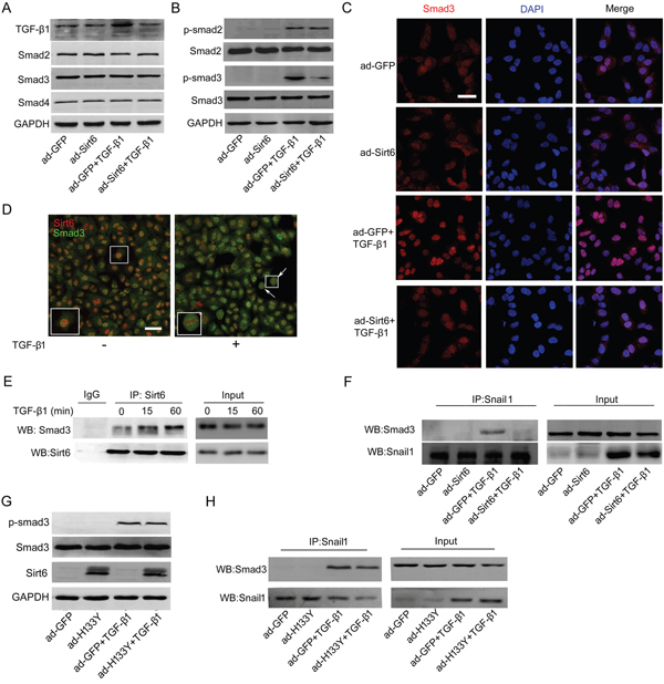 Sirt6 attenuates TGF-&#x03B2;1/Smad3 signaling.