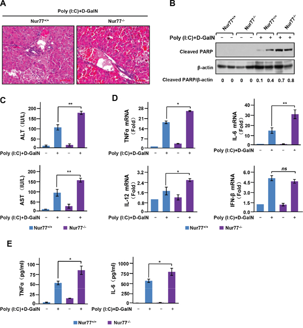 Nur77 attenuates poly (I:C)-induced acute liver inflammation.