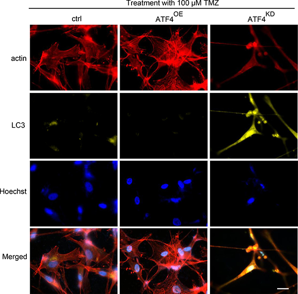 ATF4 counteracts TMZ-induced autophagy in glioma cells.