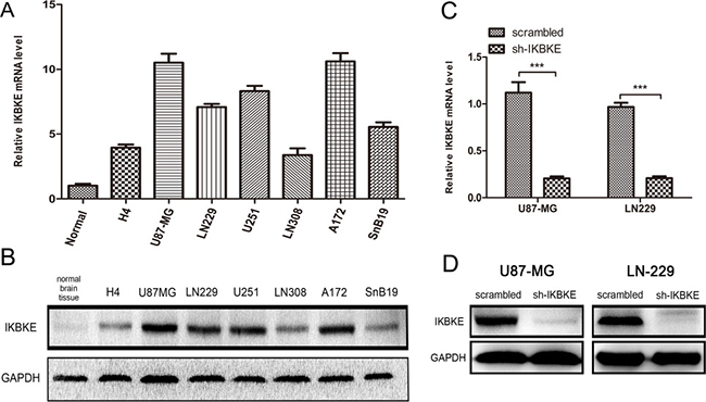 Expression of IKBKE in cell lines and silence of IKBKE using shRNA in U87-MG and LN-229.