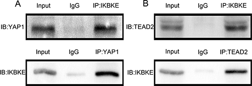 IKBKE could directly interact with YAP1, TEAD2.