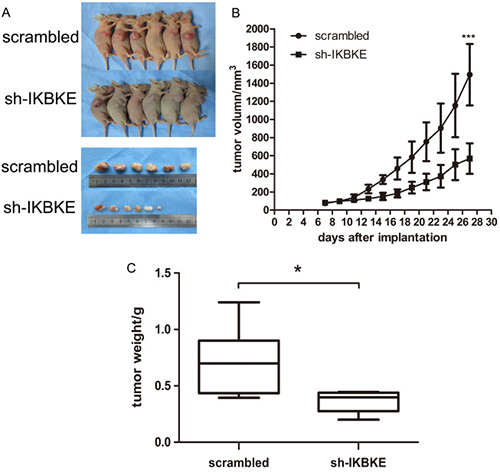 Downregulation of IKBKE inhibited tumourigenesis in subcutaneous nude mice.