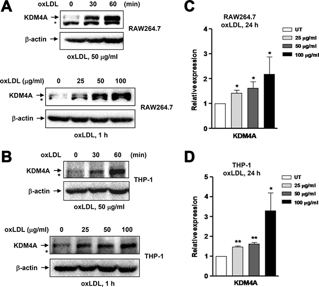 Exposure to oxLDL results in up-regulation of KDM4A in macrophages.