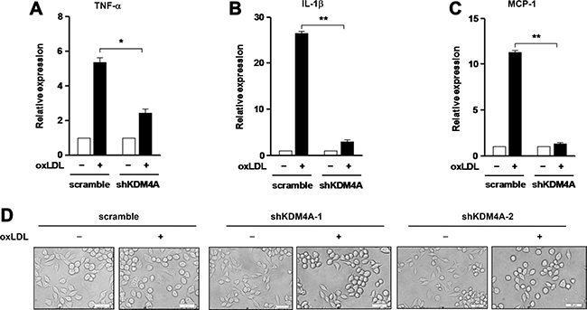 Knockdown of KDM4A prevents expression of inflammatory genes induced by oxLDL in RAW264.7 cells.