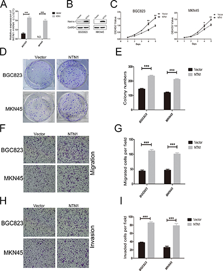 Netrin-1 overexpression increased the proliferation, migration, and invasion of GC cells in vitro.
