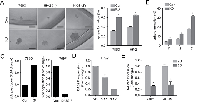 Loss of DAB2IP increases stem-like phenotypes in RCC.