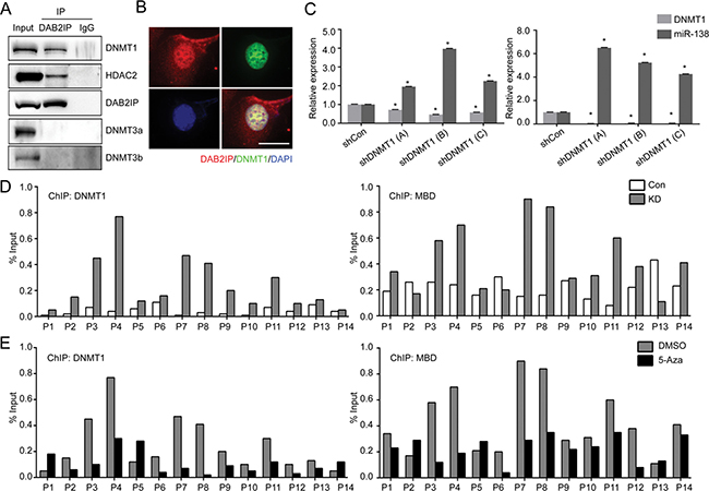 DNMT1 suppresses miR-138 expression by direct binding to the promoter region.