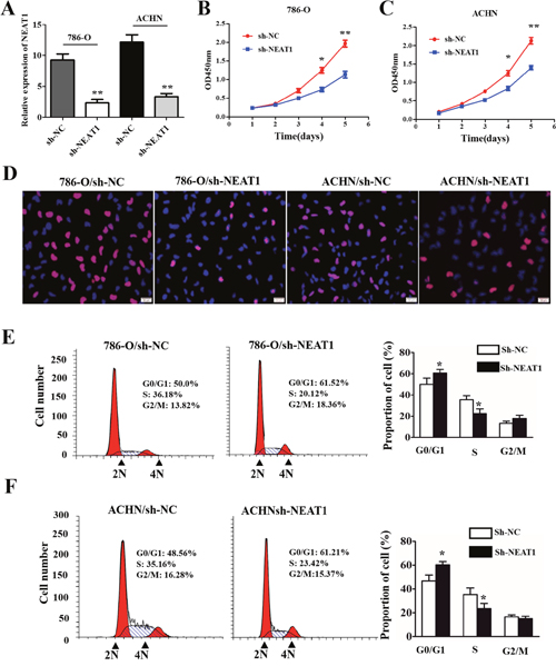 The effects of NEAT1 on RCC cell proliferation and cell cycle progression.