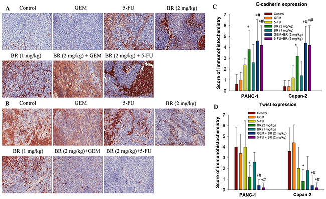 Expression of E-cadherin and Twist in the orthotopic xenograft tumor tissues by immunohistochemistry.
