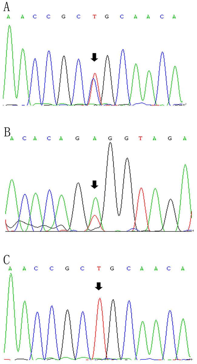LPL gene (reference sequence NM&#x005F;000237)sequencing diagram.