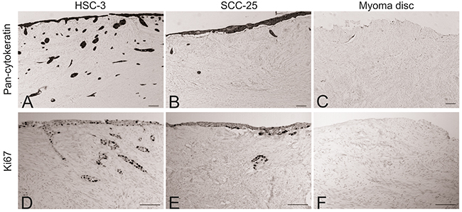 Comparison of the invasion ability of HSC-3 SCC-25 cells.