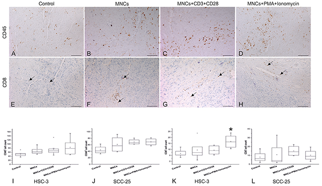 Migration of peripheral blood MNCs toward OTSCC cells through myoma discs.