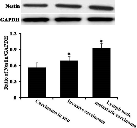 The analysis of protein content by Western blotting.