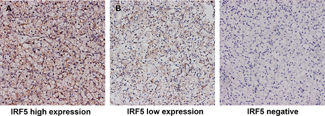 Representative pictures of IRF5 immunostaining.