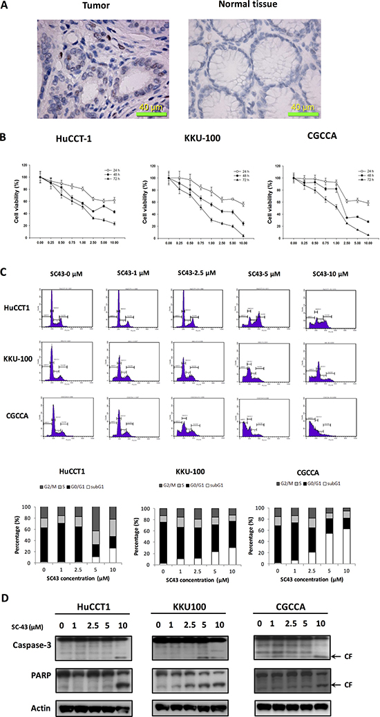 SC-43 exerts anti-proliferative and apoptosis-inducing effects in cholangiocarcinoma (CCA) cells.