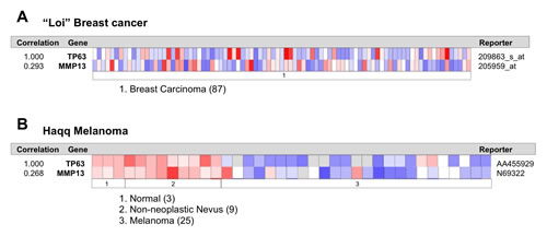 p63 and MMP13 expression directly correlates in human breast and melanoma cancers.